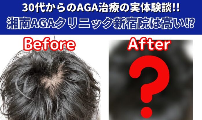実体験記事_湘南AGAクリニック新宿院